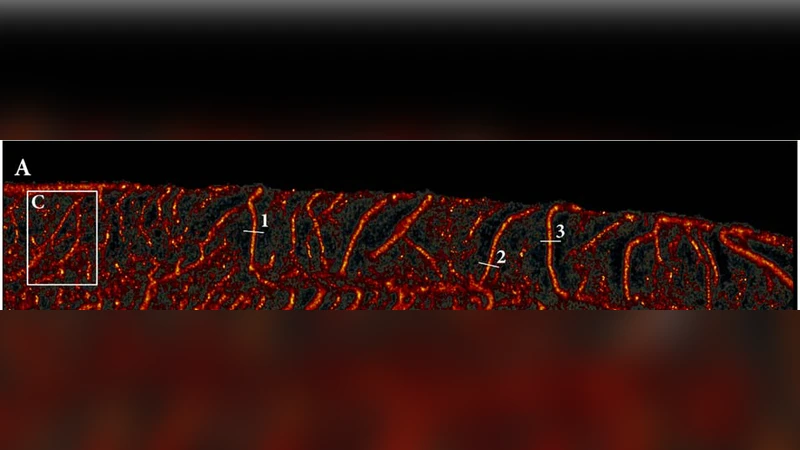 Super-resolution Ultrasound Localization Microscopy through Deep   Learning