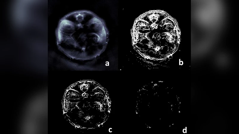 Multiscale edge detection and parametric shape modeling for boundary   delineation in optoacoustic images