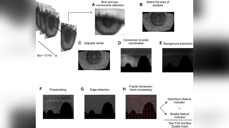 Assessment of tear film using videokeratoscopy based on fractal   dimension