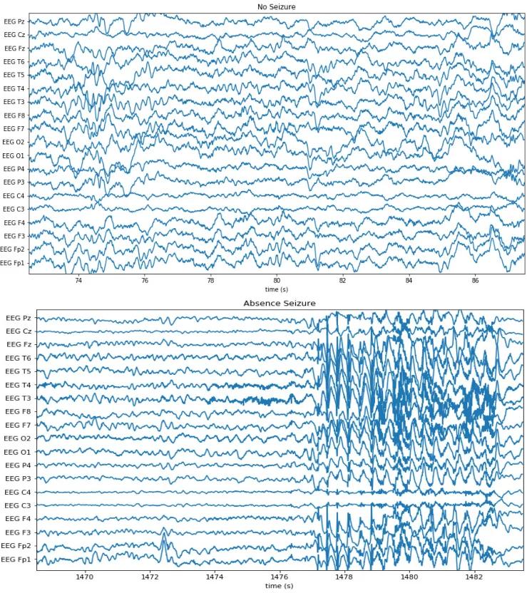 Cross-Modal Data Programming Enables Rapid Medical Machine Learning