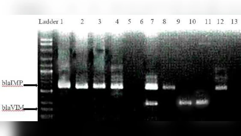 Detection of Metallo-b{eta}-Lactamases-Encoding Genes Among Clinical   Isolates of Escherichia Coli in a Tertiary Care Hospital, Malaysia