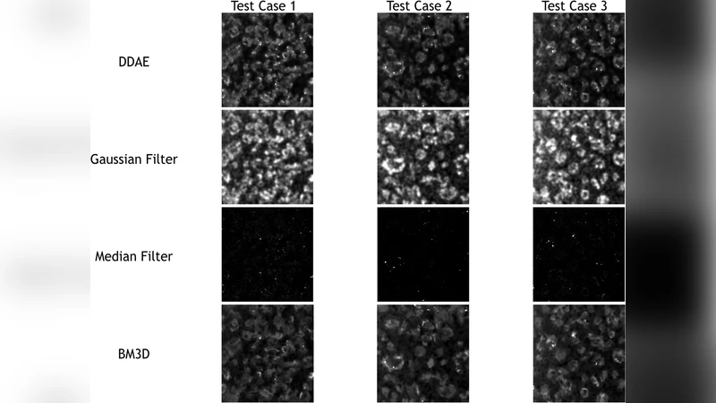 Boundary-Preserved Deep Denoising of the Stochastic Resonance Enhanced   Multiphoton Images