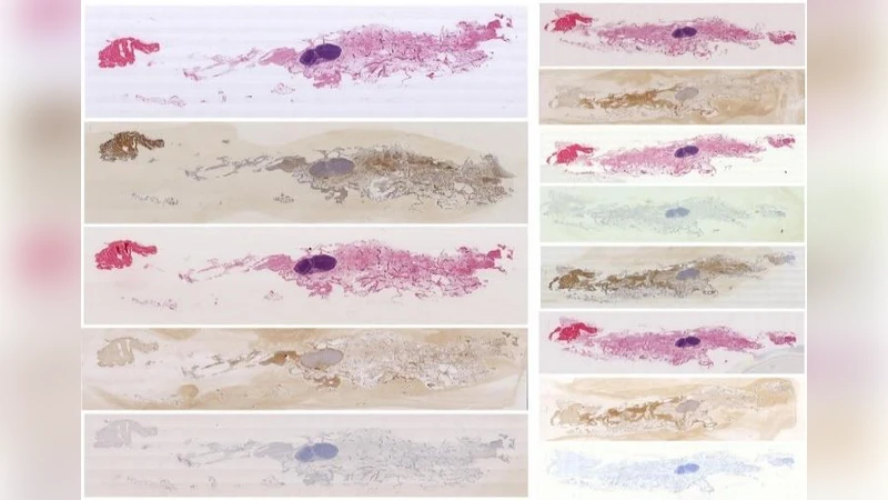 Accurate and Robust Alignment of Variable-stained Histologic Images   Using a General-purpose Greedy Diffeomorphic Registration Tool