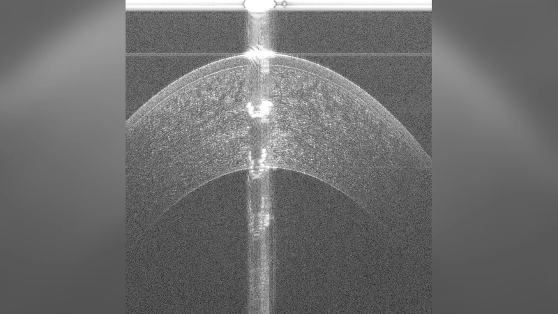 Accurate Tissue Interface Segmentation via Adversarial Pre-Segmentation   of Anterior Segment OCT Images