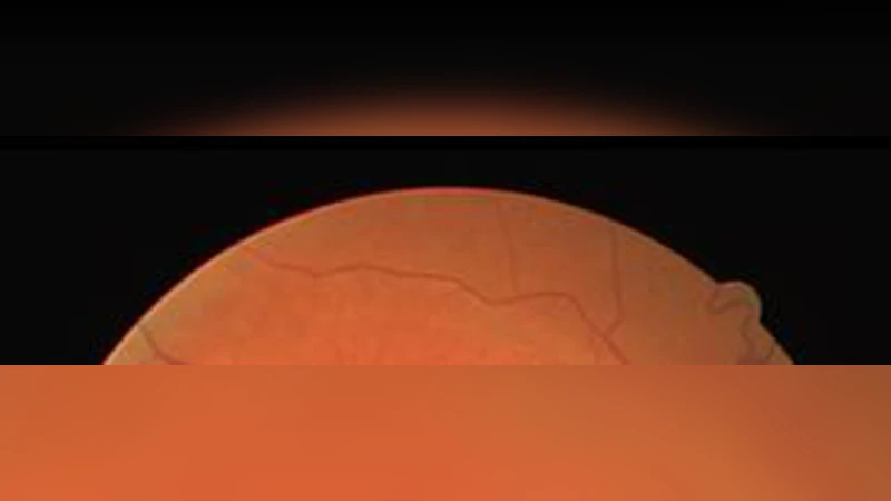 Ocular Diseases Diagnosis in Fundus Images using a Deep Learning:   Approaches, tools and Performance evaluation