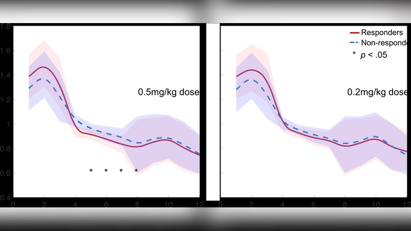 Identifying Ketamine Responses in Treatment-Resistant Depression Using a   Wearable Forehead EEG