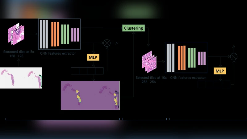 An attention-based multi-resolution model for prostate whole slide   imageclassification and localization