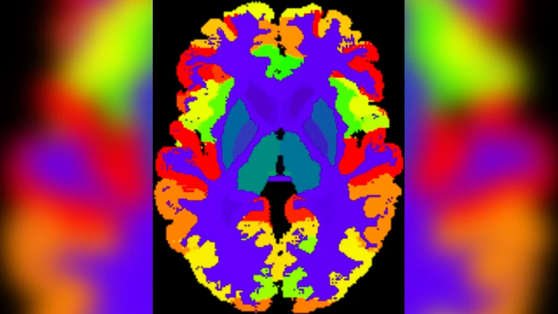 AssemblyNet: A Novel Deep Decision-Making Process for Whole Brain MRI   Segmentation