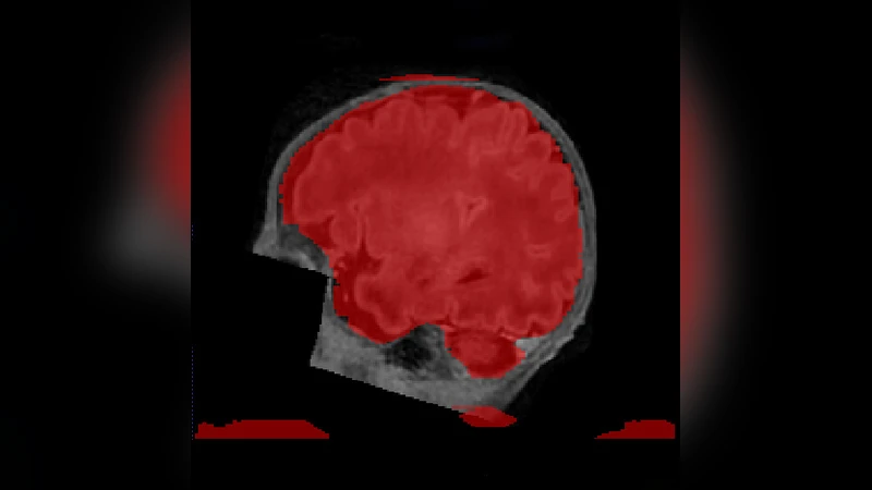 A sparse annotation strategy based on attention-guided active learning   for 3D medical image segmentation