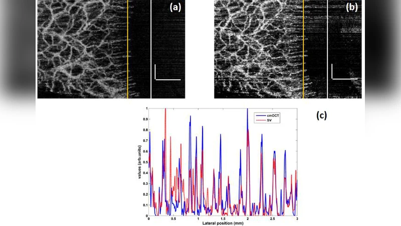 Feasibility of cmOCT angiographic technique using 200 kHz VCSEL source   for in vivo microcirculation imaging applications