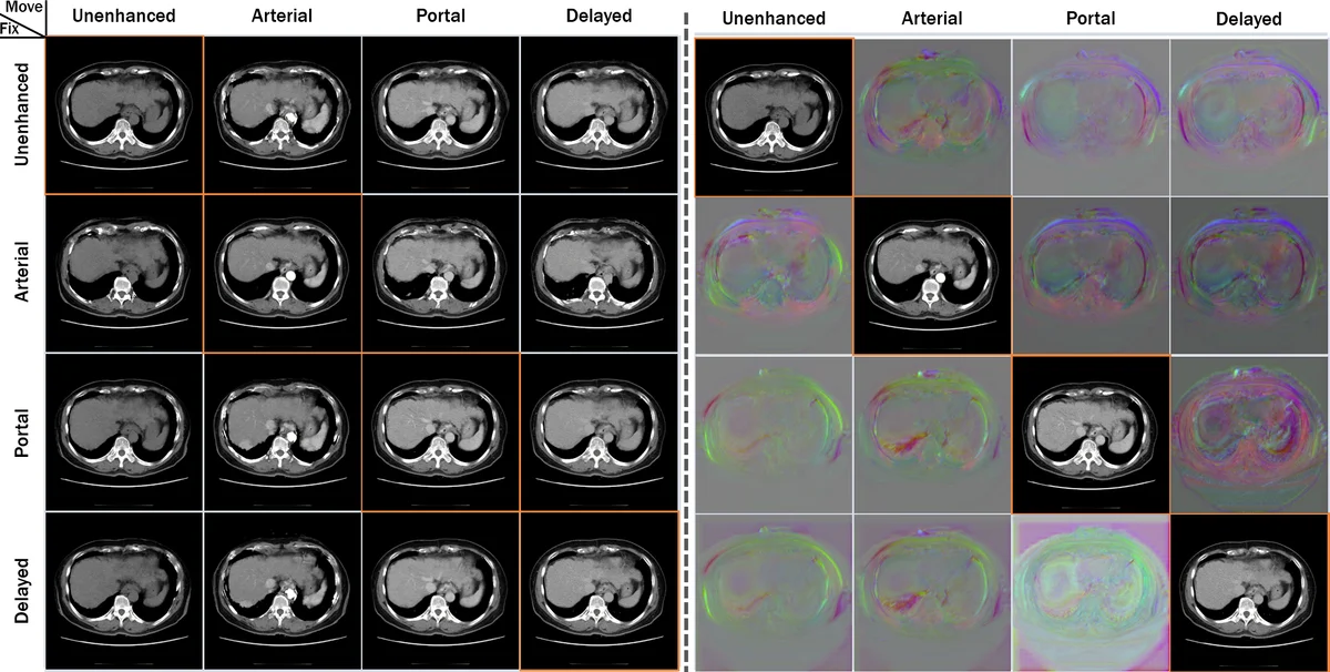 Unsupervised Deformable Image Registration Using Cycle-Consistent CNN