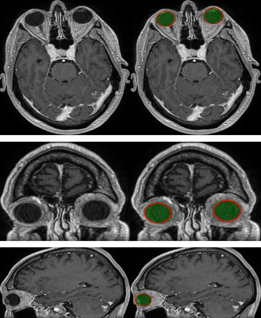 Anatomically Consistent Segmentation of Organs at Risk in MRI with   Convolutional Neural Networks