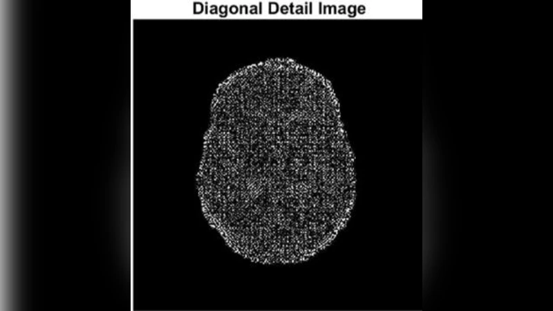 A Superpixel Segmentation Based Technique for Multiple Sclerosis Lesion   Detection