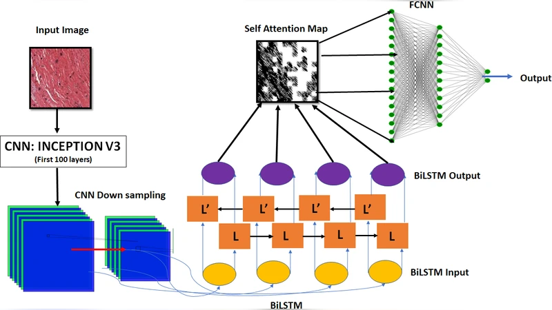 Self-attention based BiLSTM-CNN classifier for the prediction of   ischemic and non-ischemic cardiomyopathy