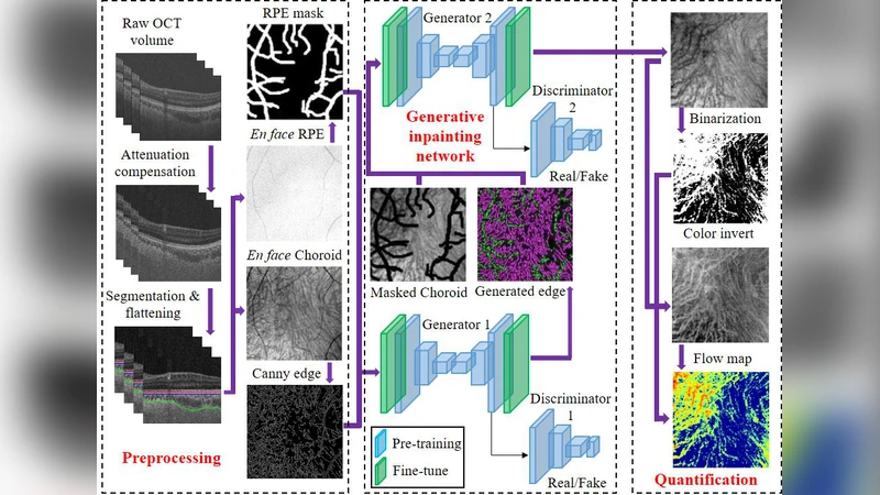 Eliminating Shadow Artifacts via Generative Inpainting Networks to   Quantify Vascular Changes of the Choroid