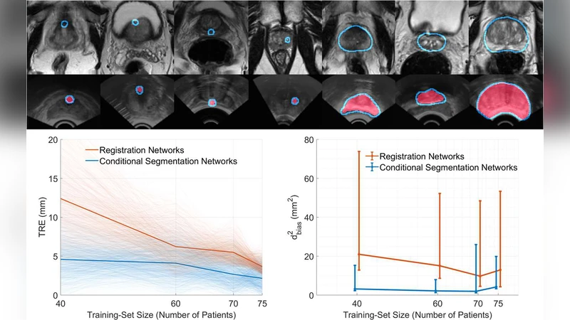Conditional Segmentation in Lieu of Image Registration