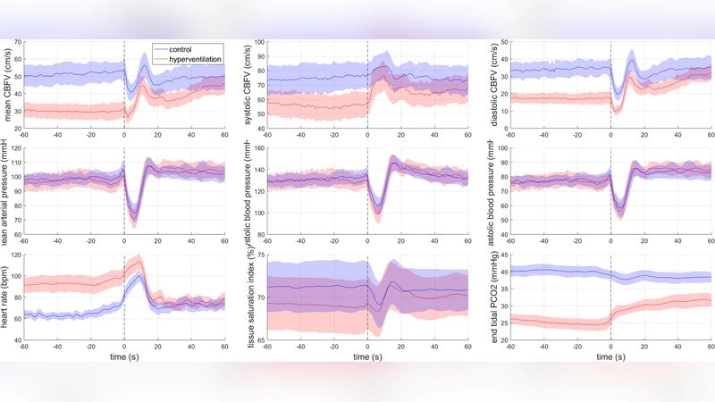 Monocular 3D Sway Tracking for Assessing Postural Instability in   Cerebral Hypoperfusion During Quiet Standing