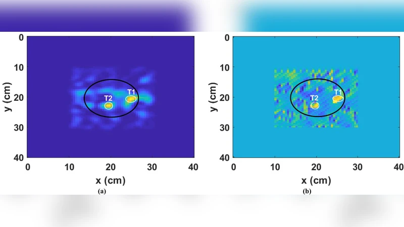 Early Detection of Cancerous Tissues in Human Breast utilizing Near   field Microwave Holography