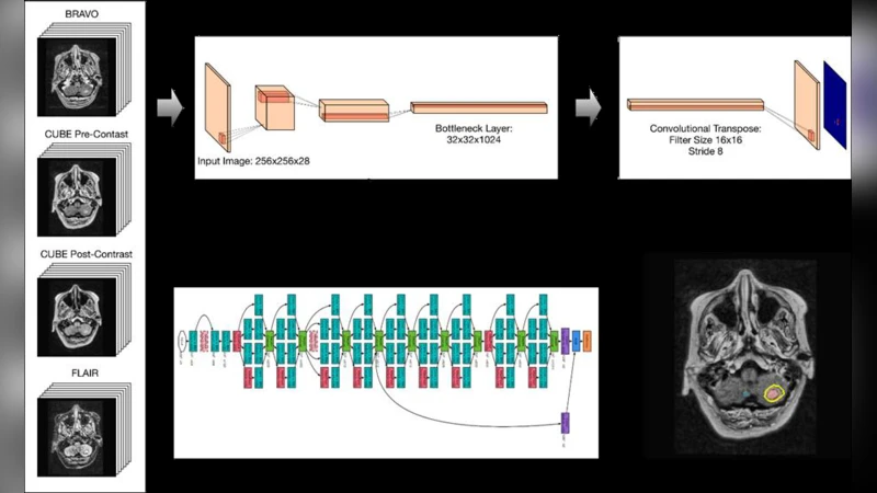 Deep Learning Enables Automatic Detection and Segmentation of Brain   Metastases on Multi-Sequence MRI