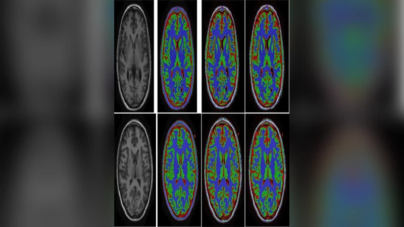 Unsupervised Segmentation Algorithms Implementation in ITK for Tissue   Classification via Human Head MRI Scans