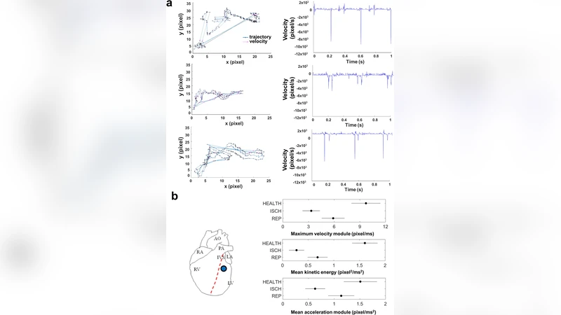 Cardiac kinematic parameters computed from video of $textit{in situ}$   beating heart