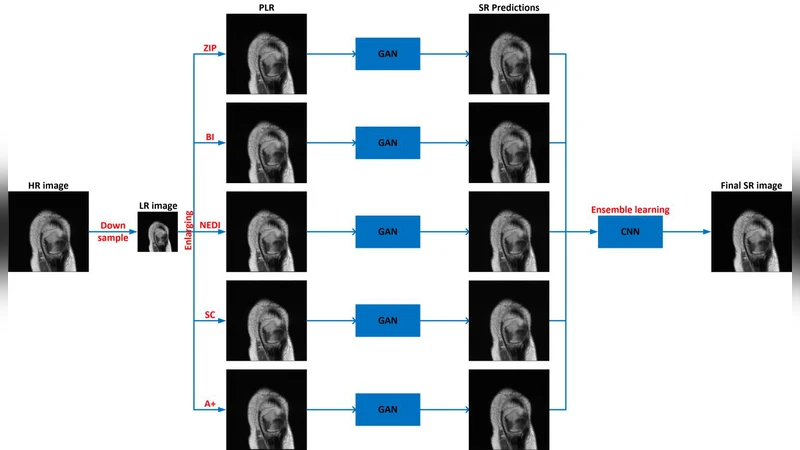 MRI Super-Resolution with Ensemble Learning and Complementary Priors