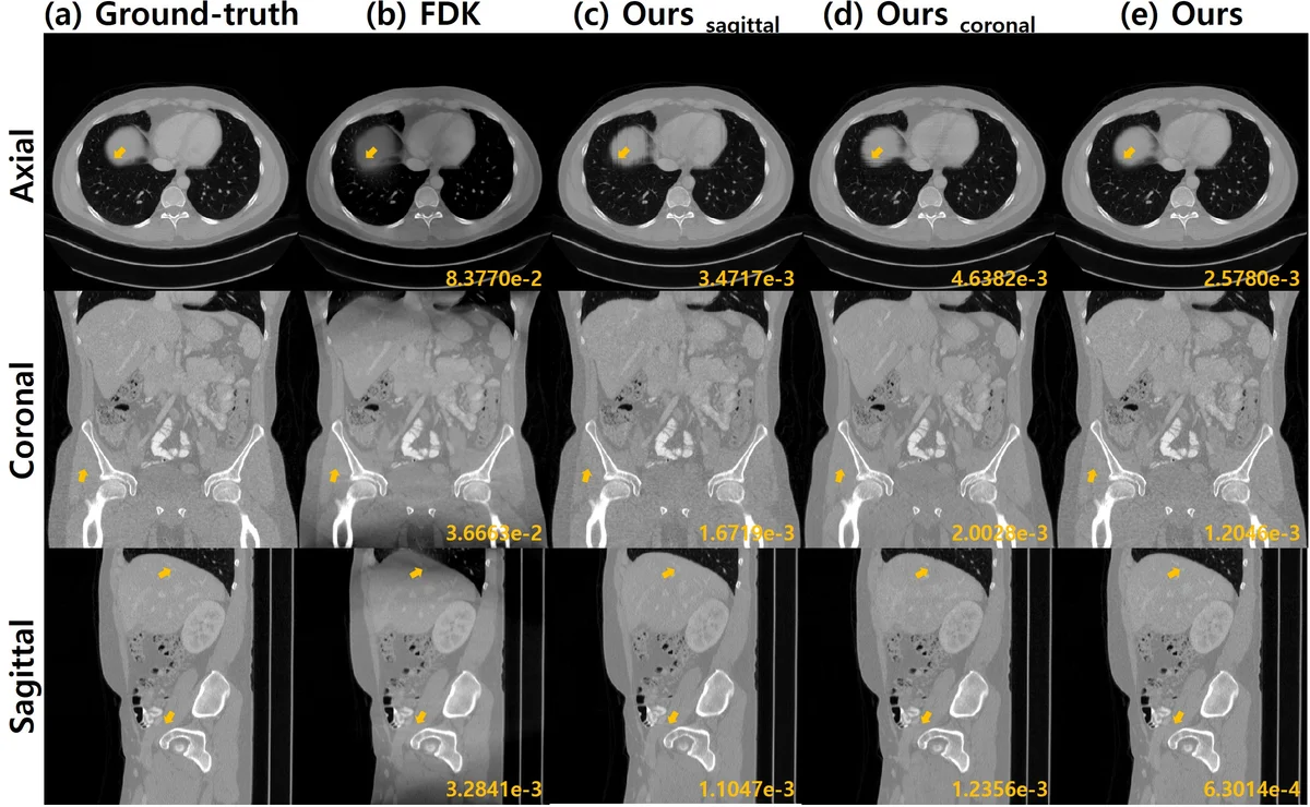 Differentiated Backprojection Domain Deep Learning for Conebeam Artifact   Removal