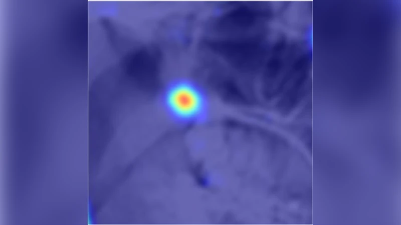 An Attention-Guided Deep Regression Model for Landmark Detection in   Cephalograms