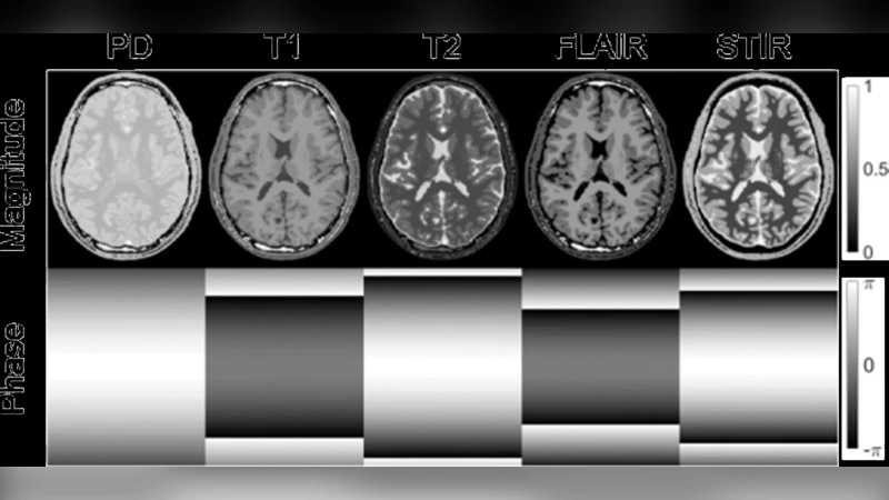Simultaneous use of Individual and Joint Regularization Terms in   Compressive Sensing: Joint Reconstruction of Multi-Channel Multi-Contrast MRI   Acquisitions