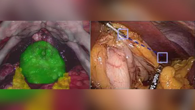 Principles of perceptual grouping: implications for image-guided surgery