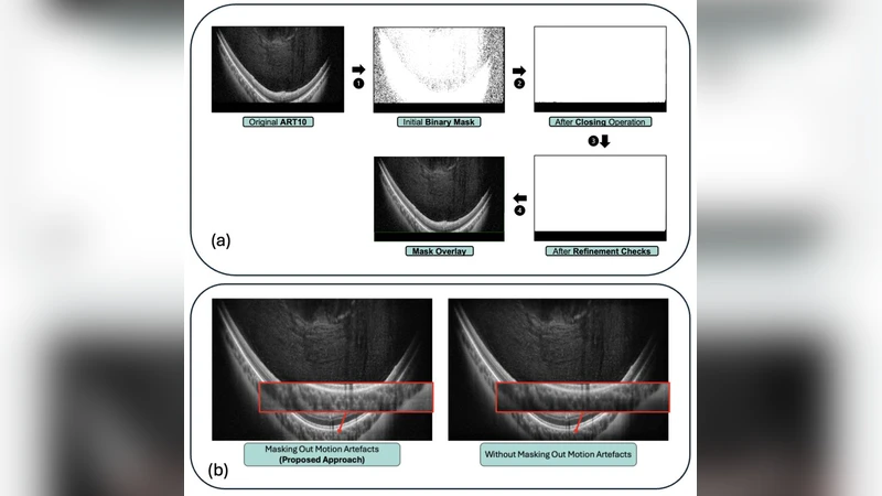 Deep Generative Models for Enhanced Vitreous OCT Imaging