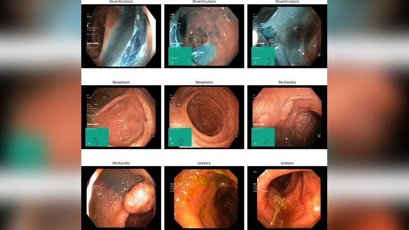 Greedy Maximal Scheduling in Wireless Networks