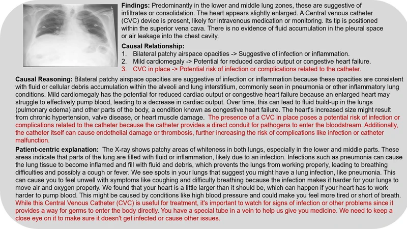 CR3G: Causal Reasoning for Patient-Centric Explanations in Radiology Report Generation
