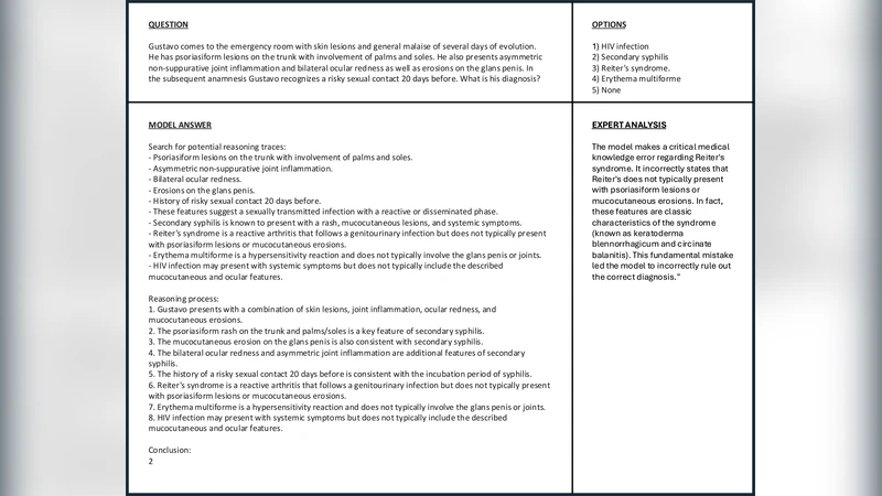 Si microring resonator crossbar array for on-chip inference and training of optical neural network