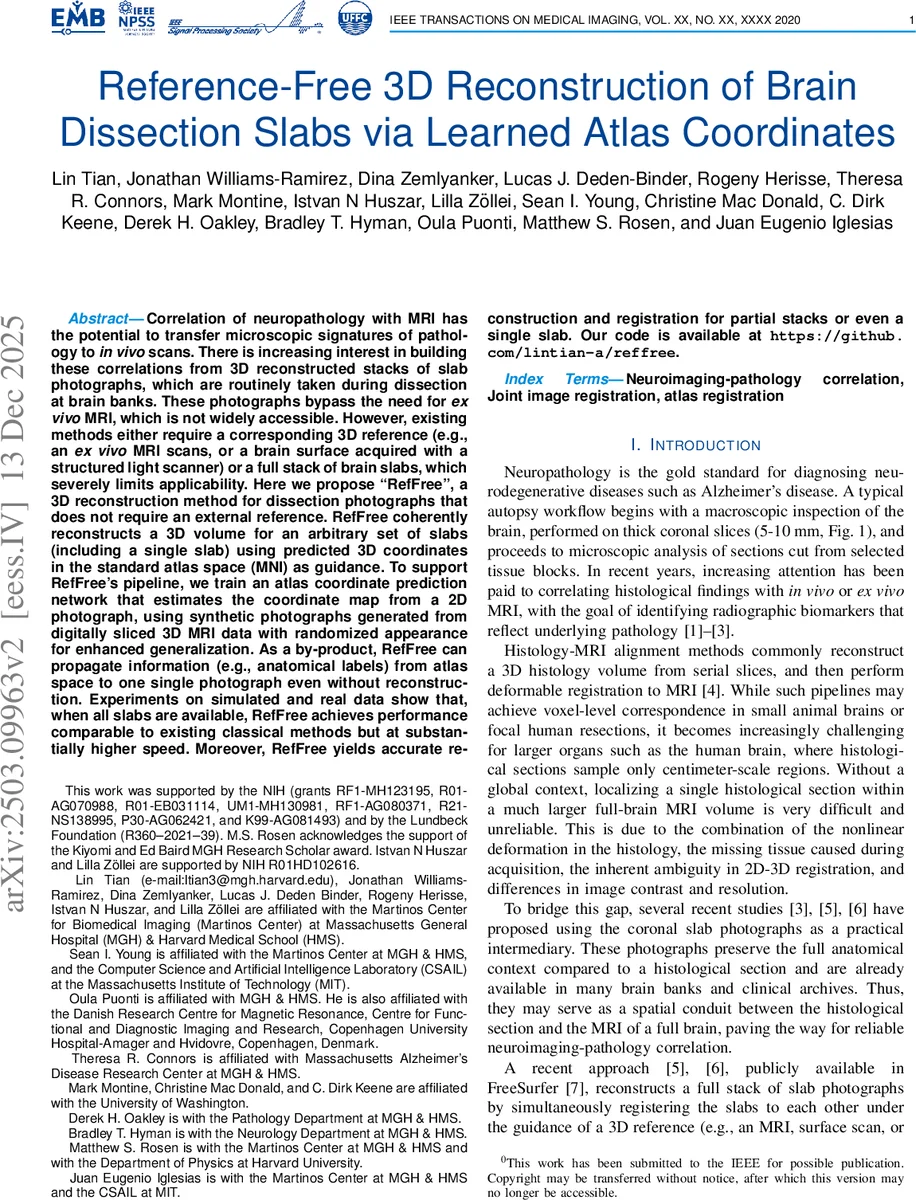 HEDN: A Hard-Easy Dual Network with Source Reliability Assessment for Cross-Subject EEG Emotion Recognition