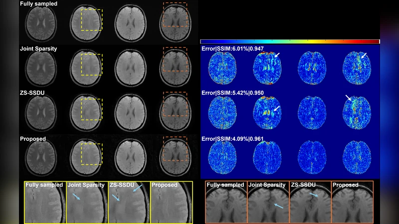 An Adaptive, Disentangled Representation for Multidimensional MRI Reconstruction