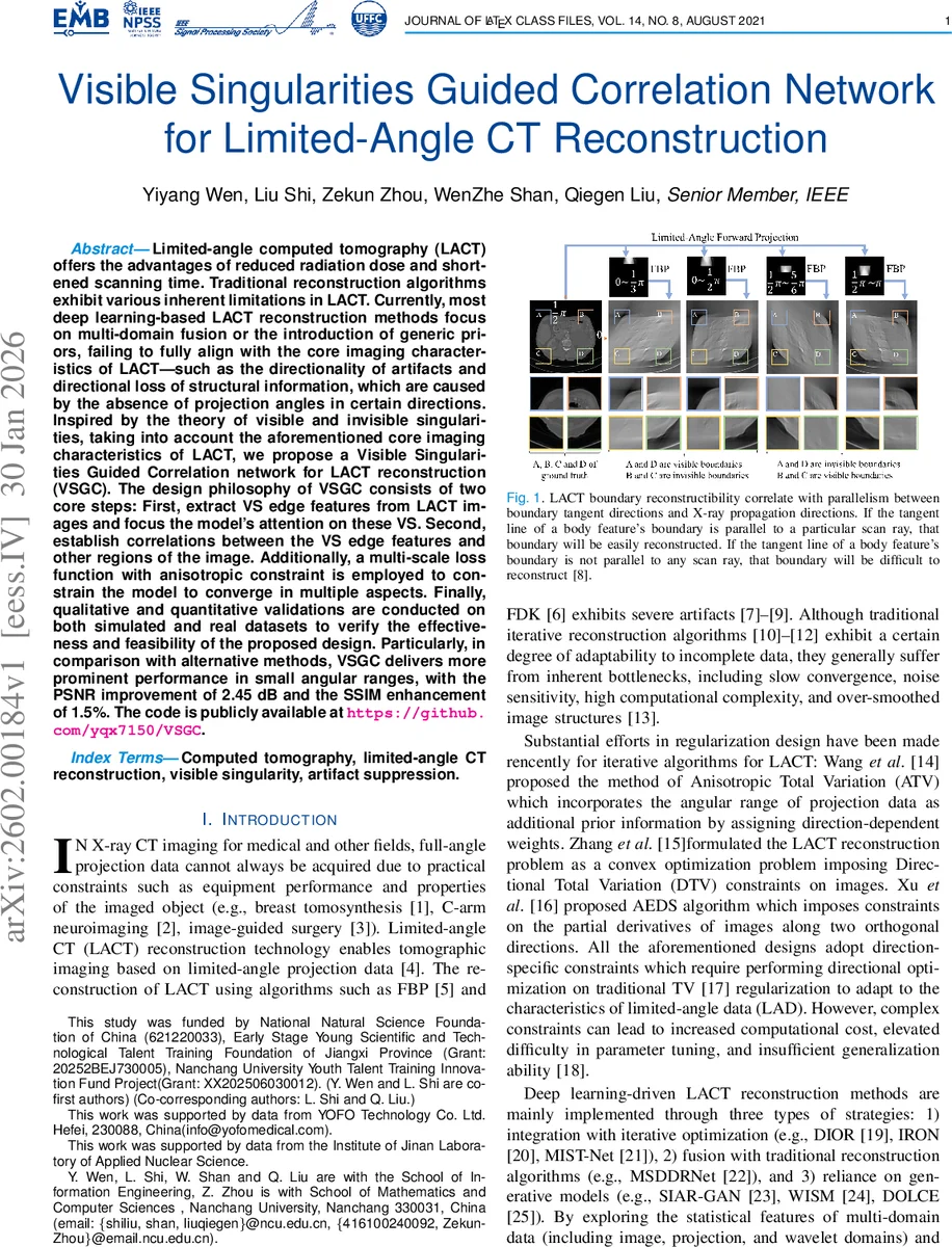 Visible Singularities Guided Correlation Network for Limited-Angle CT Reconstruction