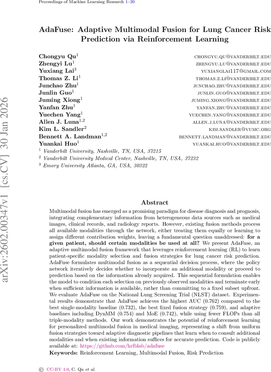 Variational Learning of Gaussian Process Latent Variable Models through Stochastic Gradient Annealed Importance Sampling