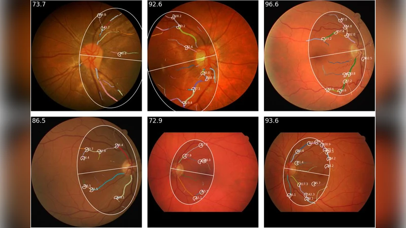 retinalysis-vascx: An explainable software toolbox for the extraction of retinal vascular biomarkers