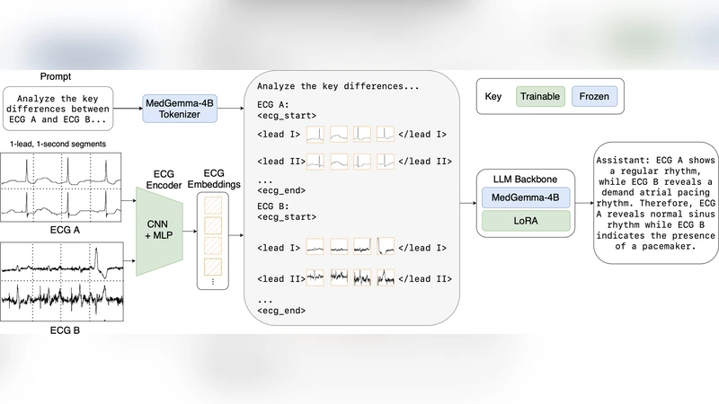 CAMEL: An ECG Language Model for Forecasting Cardiac Events