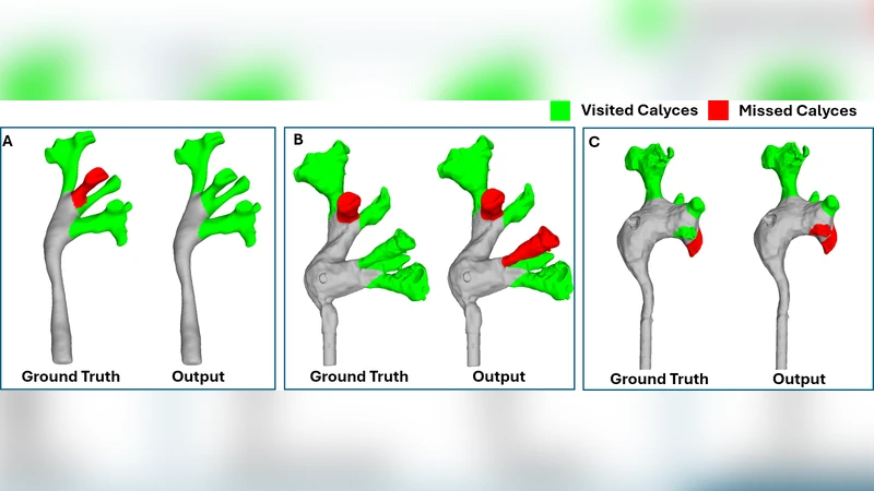 Automated Assessment of Kidney Ureteroscopy Exploration for Training