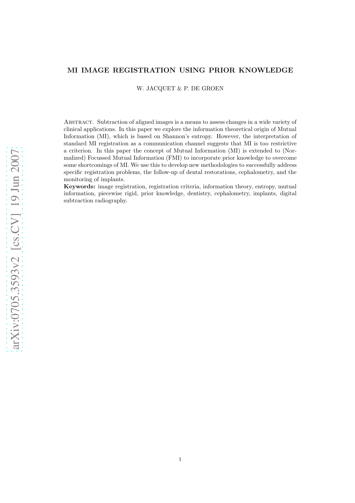 MI image registration using prior knowledge