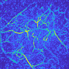 Model based learning for accelerated, limited-view 3D photoacoustic   tomography