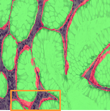 testA_overlay_transunet.png