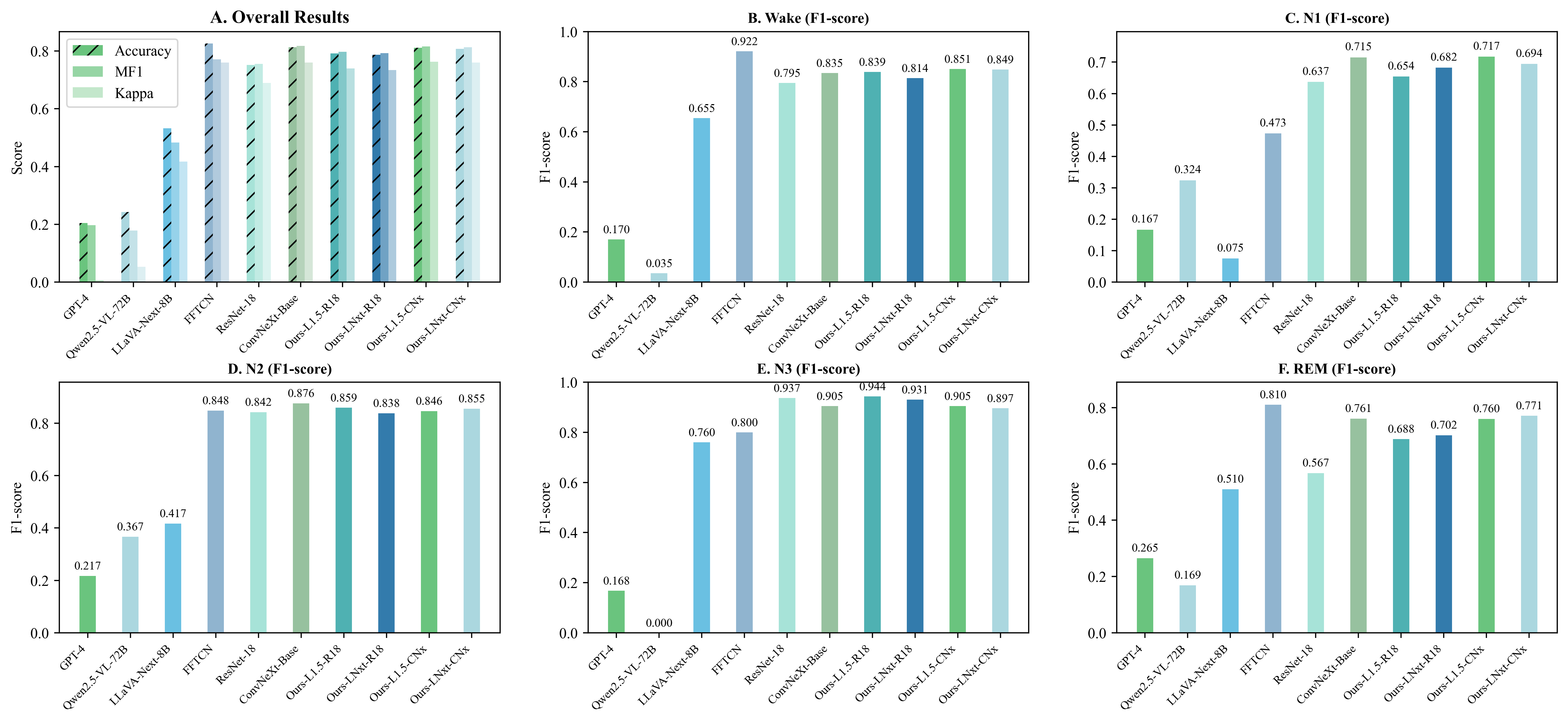 performance_comparison_sleep_edfx_1_v4.png
