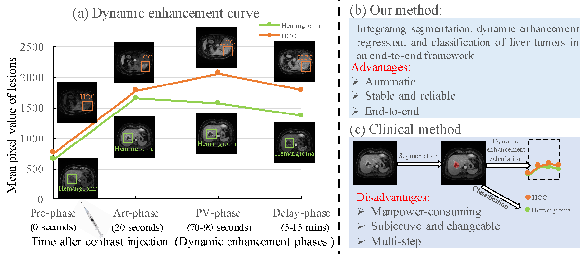 다중과제 상호작용 적대학습 기반 간 종양 영상 통합 분석 네트워크 (MTI‑Net)