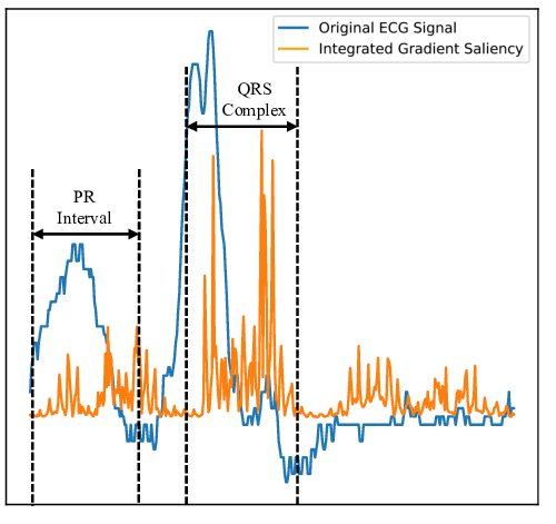 EnECG: Efficient Ensemble Learning for Electrocardiogram Multi-task Foundation Model