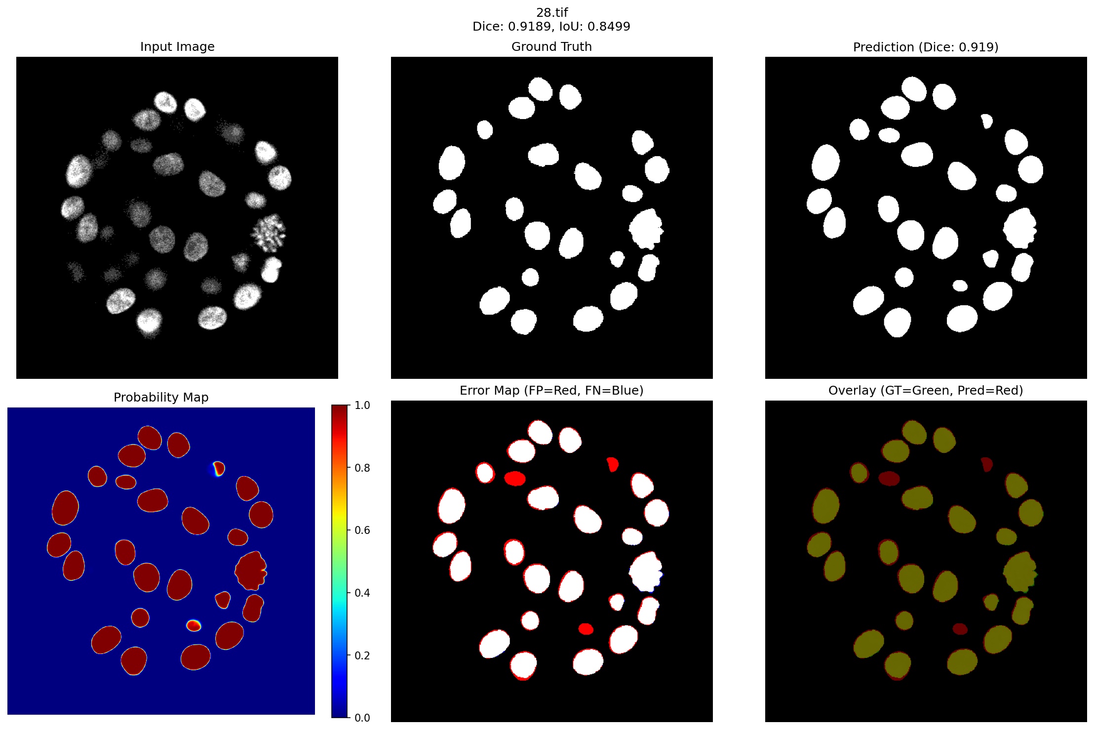 Breast Cell Segmentation Under Extreme Data Constraints: Quantum Enhancement Meets Adaptive Loss Stabilization