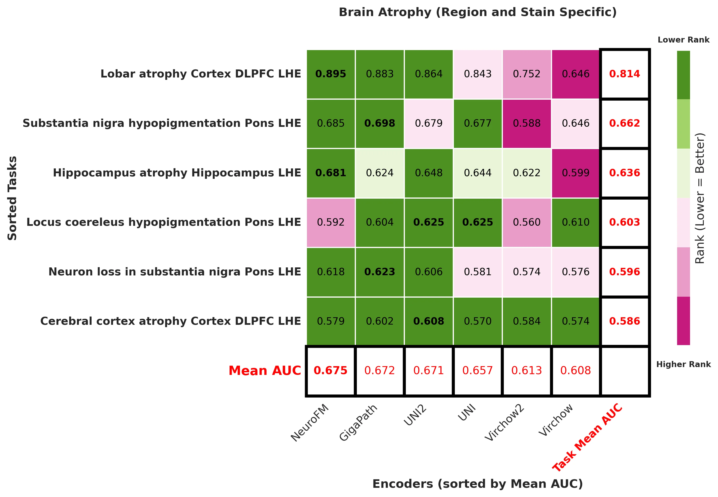 Ranking_heatmap_Brain_Atrophy_Region_and_Stain_Specific_sorted.webp