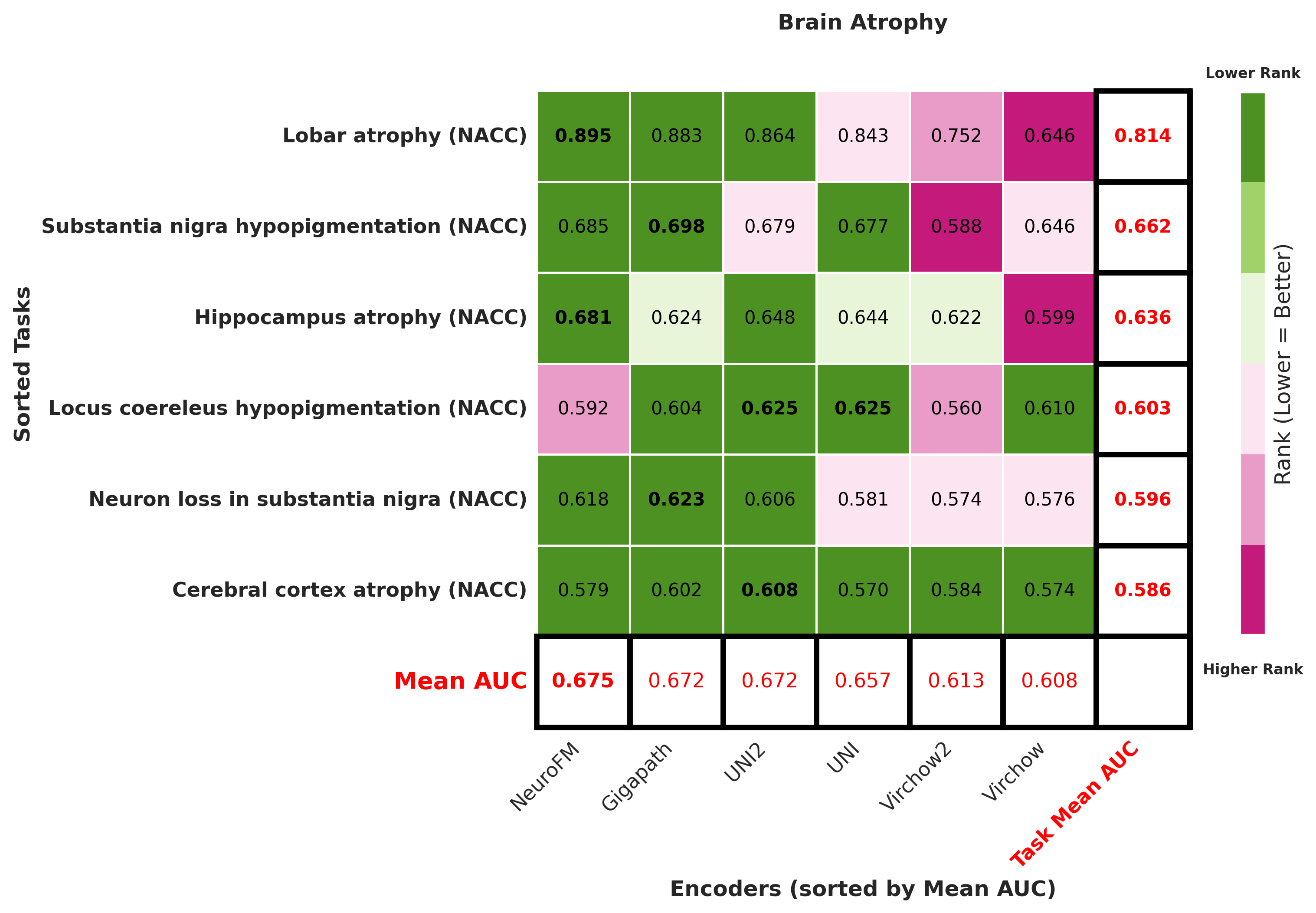 Ranking_heatmap_Brain_Atrophy_sorted.png